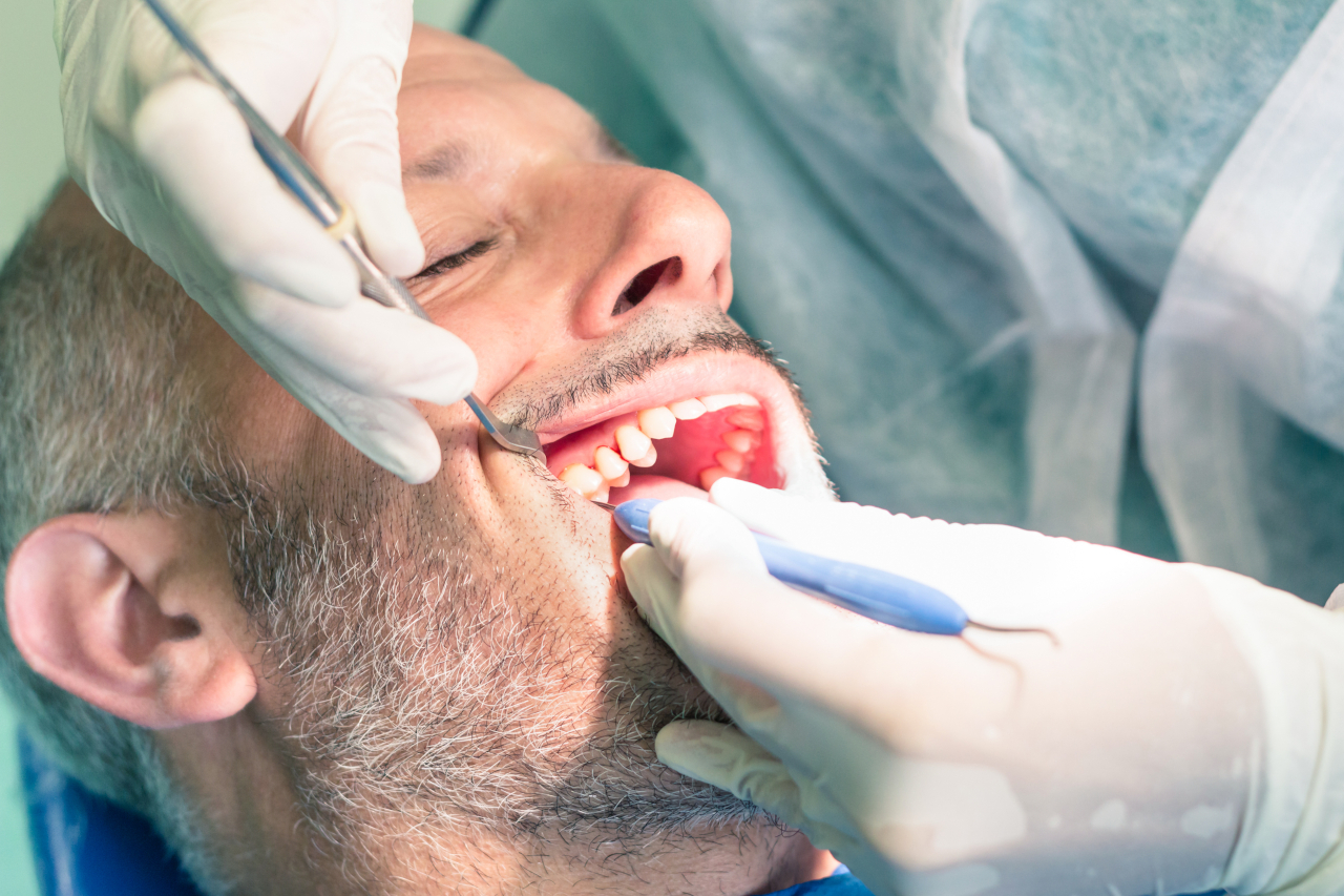 Dream Dental | Dental Cleaning in Toms River, NJ: What Happens If You Keep Putting It Off? Dream Dental | Dental Cleaning in Toms River, NJ: What Happens If You Keep Putting It Off?