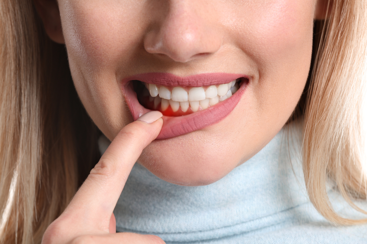 Dream Dental | Gum Disease in Toms River, NJ: Early Signs You Should Not Ignore Dream Dental | Gum Disease in Toms River, NJ: Early Signs You Should Not Ignore